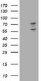 PHD Finger Protein 21B antibody, CF503284, Origene, Western Blot image 
