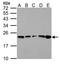 Glutathione Peroxidase 1 antibody, GTX116040, GeneTex, Western Blot image 