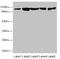 Desmocollin 2 antibody, LS-C675662, Lifespan Biosciences, Western Blot image 