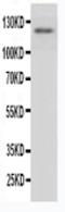 Myeloperoxidase antibody, PA1054, Boster Biological Technology, Western Blot image 