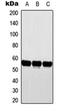 Cytochrome P450 Family 2 Subfamily D Member 6 antibody, orb213823, Biorbyt, Western Blot image 