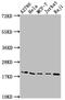 Eukaryotic Translation Initiation Factor 5A antibody, CSB-RA932542A0HU, Cusabio, Western Blot image 