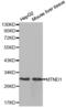 Mitochondrially Encoded NADH:Ubiquinone Oxidoreductase Core Subunit 1 antibody, abx004029, Abbexa, Western Blot image 