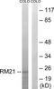 Mitochondrial Ribosomal Protein L21 antibody, TA316239, Origene, Western Blot image 