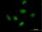 RPA Interacting Protein antibody, H00084268-B01P, Novus Biologicals, Immunocytochemistry image 