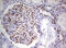 Probable ATP-dependent RNA helicase DDX56 antibody, M10946, Boster Biological Technology, Immunohistochemistry paraffin image 