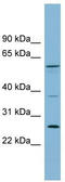 Ganglioside Induced Differentiation Associated Protein 2 antibody, TA344978, Origene, Western Blot image 