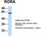 Nuclear receptor ROR-alpha antibody, TA337923, Origene, Western Blot image 