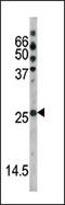 Cyclin Dependent Kinase Inhibitor 1B antibody, AP12667PU-N, Origene, Western Blot image 