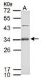 R-Spondin 1 antibody, GTX127912, GeneTex, Western Blot image 