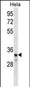 Low Density Lipoprotein Receptor Class A Domain Containing 2 antibody, PA5-35121, Invitrogen Antibodies, Western Blot image 