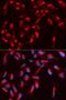 WASL antibody, LS-C332179, Lifespan Biosciences, Immunofluorescence image 