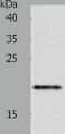 Zinc And Ring Finger 1 antibody, TA322144, Origene, Western Blot image 
