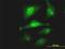 pro-SAAS antibody, H00027344-M02, Novus Biologicals, Immunocytochemistry image 