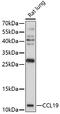 C-C Motif Chemokine Ligand 19 antibody, 16-819, ProSci, Western Blot image 