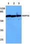 72 kDa inositol polyphosphate 5-phosphatase antibody, PA5-37119, Invitrogen Antibodies, Western Blot image 