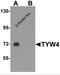 Leucine Carboxyl Methyltransferase 2 antibody, 6379, ProSci Inc, Western Blot image 