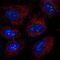 Leucine Rich Repeat Containing 23 antibody, PA5-63449, Invitrogen Antibodies, Immunofluorescence image 