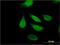 Ribosomal RNA-processing protein 44 antibody, H00022894-M01, Novus Biologicals, Immunocytochemistry image 