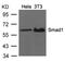 SMAD Family Member 1 antibody, orb76562, Biorbyt, Western Blot image 