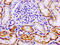 Laminin Subunit Alpha 3 antibody, LS-C670558, Lifespan Biosciences, Immunohistochemistry paraffin image 