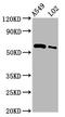 Poly(ADP-Ribose) Polymerase Family Member 3 antibody, CSB-PA017467EA01HU, Cusabio, Western Blot image 