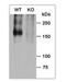 Brain-specific angiogenesis inhibitor 1 antibody, NB110-81586, Novus Biologicals, Western Blot image 
