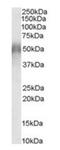CD2 Cytoplasmic Tail Binding Protein 2 antibody, orb19020, Biorbyt, Western Blot image 