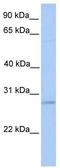 ORAI Calcium Release-Activated Calcium Modulator 2 antibody, TA339631, Origene, Western Blot image 