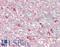 Myeloid Derived Growth Factor antibody, LS-B15251, Lifespan Biosciences, Immunohistochemistry paraffin image 