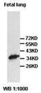 VPS26A antibody, orb77591, Biorbyt, Western Blot image 