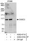 Protein CASC3 antibody, A302-471A, Bethyl Labs, Immunoprecipitation image 