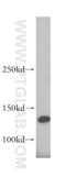 Collagen alpha-2(VI) chain antibody, 14853-1-AP, Proteintech Group, Western Blot image 