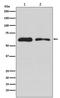 Dopa Decarboxylase antibody, M01374-1, Boster Biological Technology, Western Blot image 