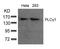 Phospholipase C Gamma 1 antibody, 79-552, ProSci, Western Blot image 