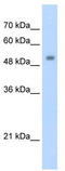 Zinc Finger And SCAN Domain Containing 21 antibody, TA345531, Origene, Western Blot image 