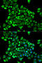 Cytidine Deaminase antibody, A01578, Boster Biological Technology, Western Blot image 