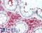 RING finger protein 43 antibody, LS-B15814, Lifespan Biosciences, Immunohistochemistry paraffin image 