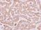 Ribosomal Protein L15 antibody, NBP2-20212, Novus Biologicals, Immunohistochemistry paraffin image 