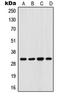 Four And A Half LIM Domains 3 antibody, LS-C352194, Lifespan Biosciences, Western Blot image 