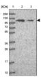 UTP14C Small Subunit Processome Component antibody, PA5-61468, Invitrogen Antibodies, Western Blot image 