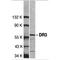 TNF Receptor Superfamily Member 25 antibody, TA305945, Origene, Western Blot image 