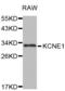 Potassium voltage-gated channel subfamily E member 1 antibody, abx001090, Abbexa, Western Blot image 