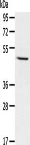Cytochrome P450 Family 1 Subfamily A Member 1 antibody, TA321142, Origene, Western Blot image 