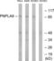 Patatin Like Phospholipase Domain Containing 8 antibody, LS-C119797, Lifespan Biosciences, Western Blot image 