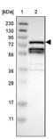 Receptor-interacting serine/threonine-protein kinase 1 antibody, NBP1-87128, Novus Biologicals, Western Blot image 