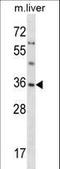 Small glutamine-rich tetratricopeptide repeat-containing protein alpha antibody, LS-C169050, Lifespan Biosciences, Western Blot image 