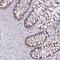 Zinc Finger Protein 362 antibody, PA5-63691, Invitrogen Antibodies, Immunohistochemistry paraffin image 