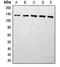 Histone Deacetylase 5 antibody, orb214952, Biorbyt, Western Blot image 