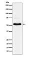 Solute Carrier Family 17 Member 7 antibody, M03664, Boster Biological Technology, Western Blot image 